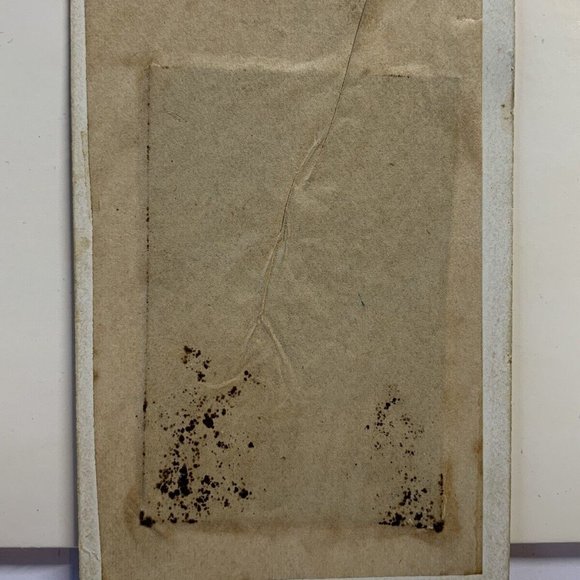 1880’s Skull Base Tumor On Mans Head Medical Daguerreotype photograph Golf Ball! - Picture 4 of 4